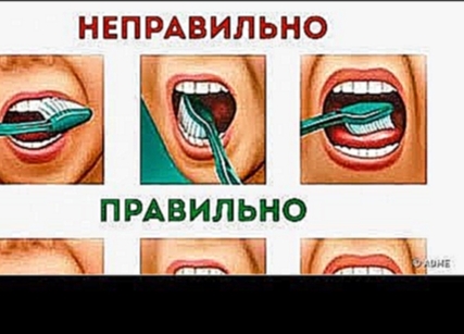 Как правильно чистить зубы зубной щеткой 
