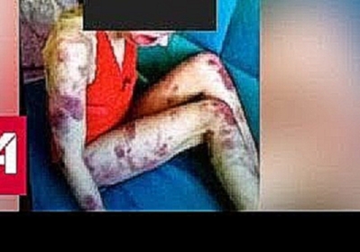 Ревнивец забил жену до смерти, а фото выложил в Интернет - Россия 24 