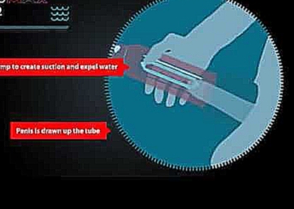 Bathmate видео, как пользоваться гидропомпой 